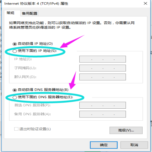 設(shè)置IP地址
